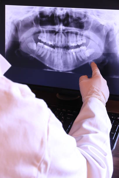 Best Emergency Root Canal Treatment in Tuckerton, NJ
